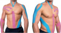 /album/fotogaleria/kinesiotaping1-jpg/